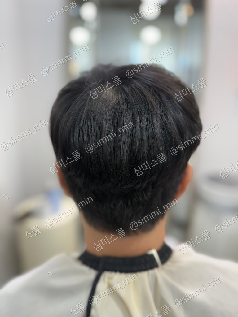 악성곱슬 남성 고객 시술 후